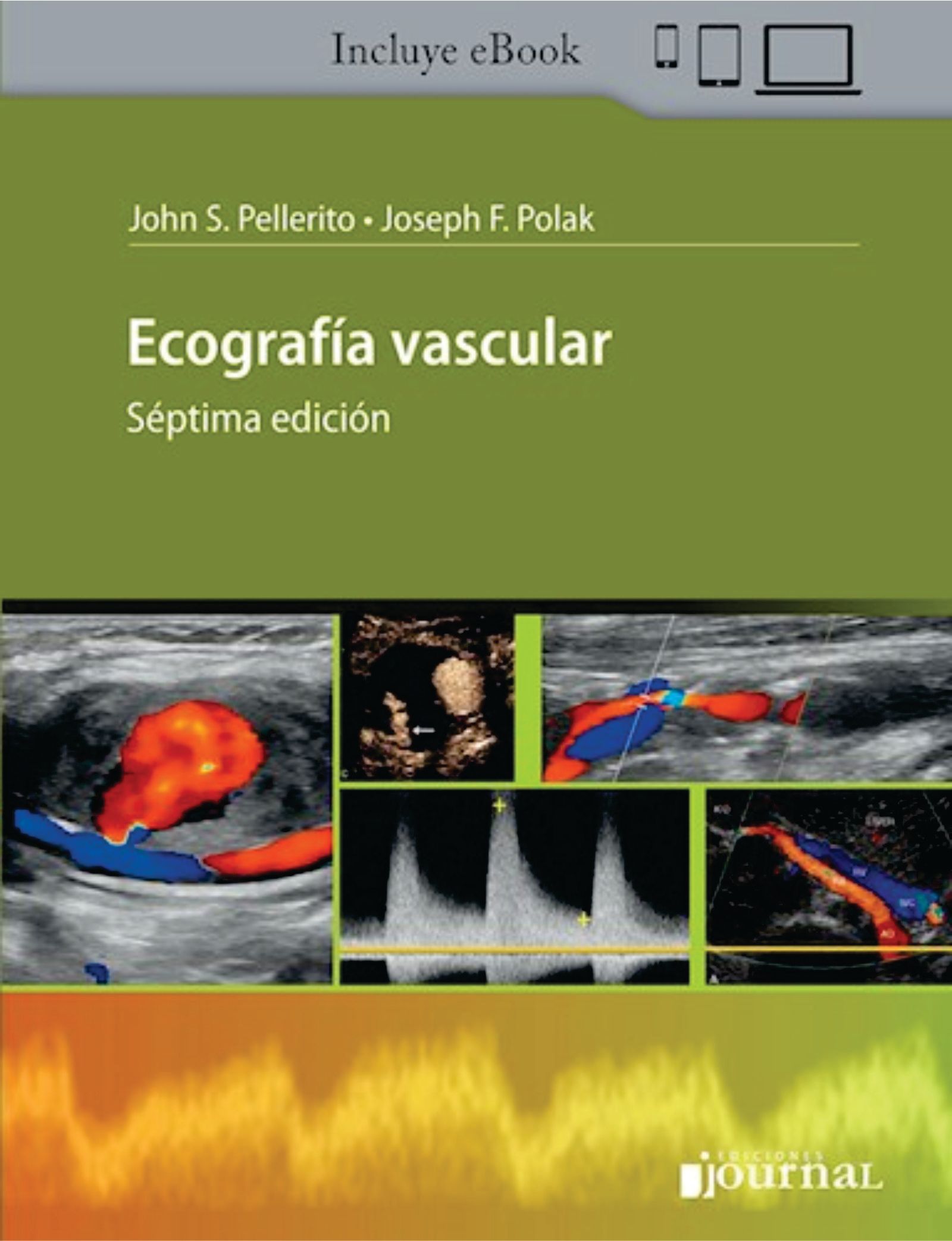 Ecografía Vascular Ed.7